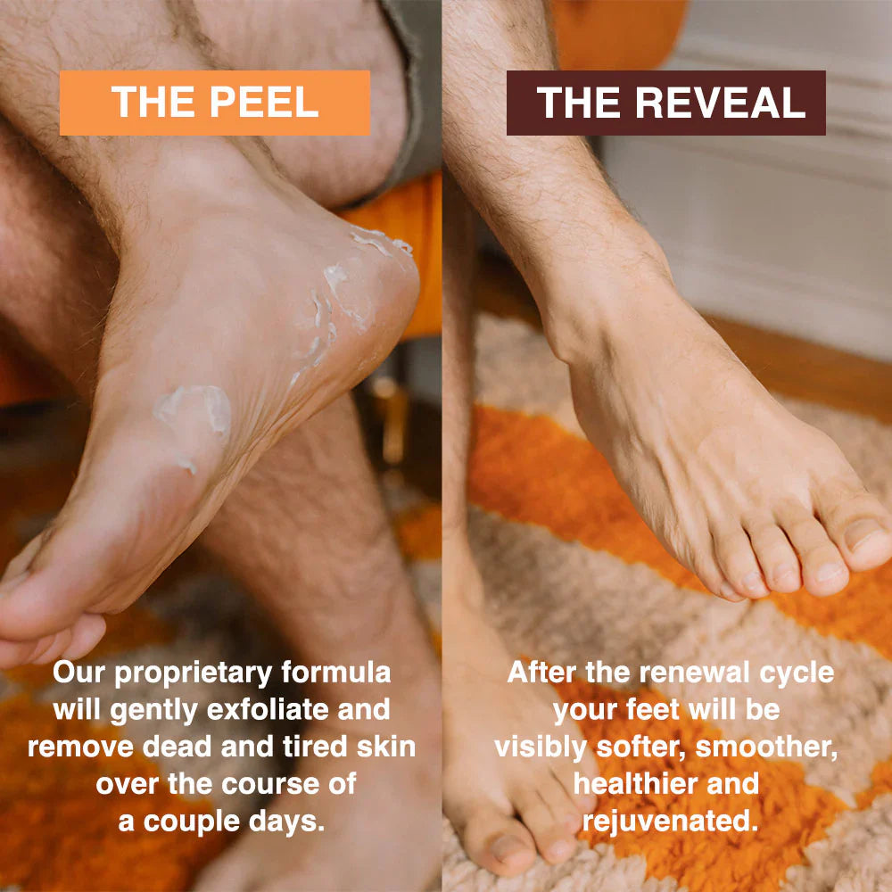 Sadoer Glycolic Acid Foot Peeling Mask (1 Pair), Korean Peeling & Exfoliating | Deep Exfoliation with Glycolic Acid, Removes Dead Skin, Cruelty-Free, Foot Peel Off Mask